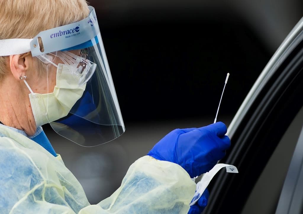 health-canada-gives-green-light-to-a-rapid-test-for-covid-19