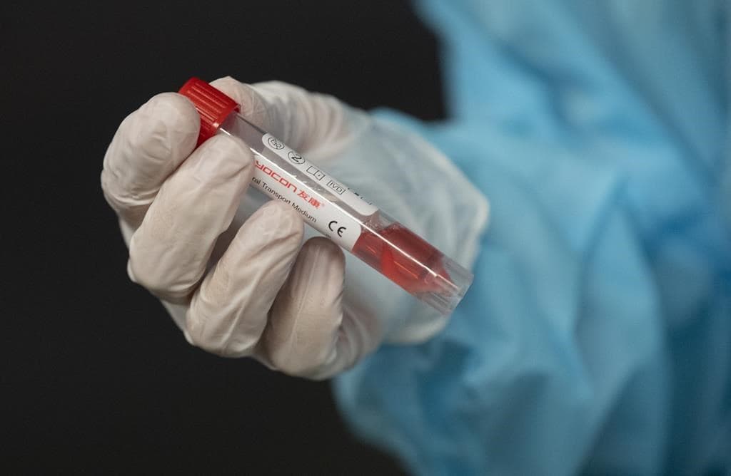 outbreak-of-covid-19-at-two-lodges-where-people-working-on-the-coastal-gaslink-pipeline-project-have-been-staying